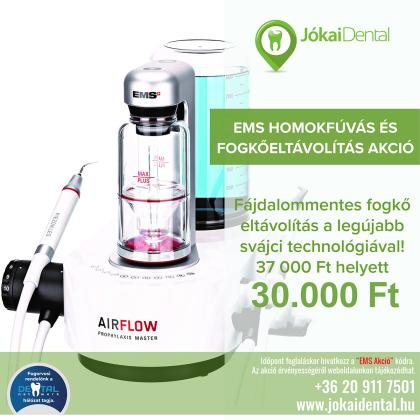 EMS Homokfúvás és Fogkőeltávolítás AKCIÓ! EMS Homokfúvás és Fogkőeltávolítás AKCIÓ!
