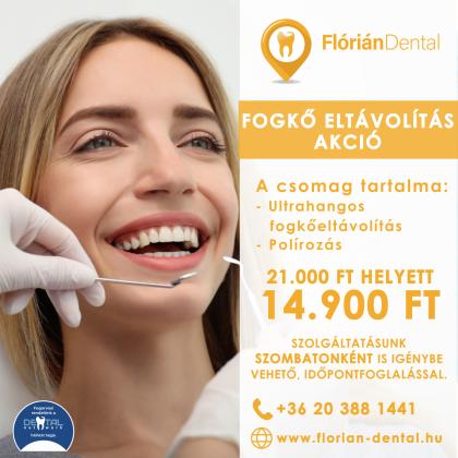 Fogkő eltávolítás AKCIÓ