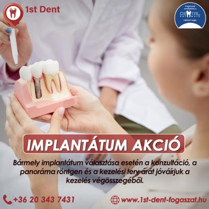 Implantátum Akció