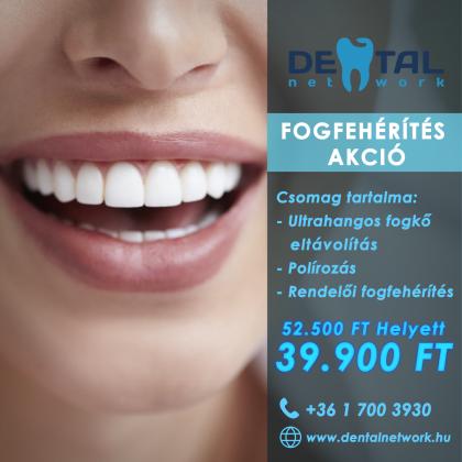 Fogfehérítés akció