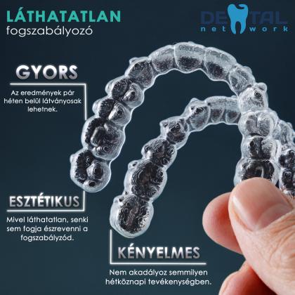 Átlátszó fogszabályozás