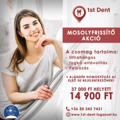 Fogkő-eltávolítás Akció Fogkő-eltávolítás Akció