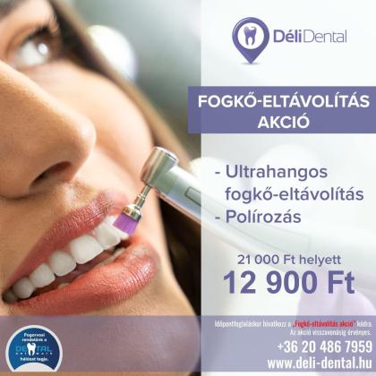 Mosolyfrissítő AKCIÓ Mosolyfrissítő AKCIÓ