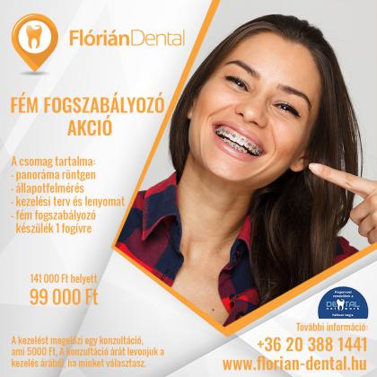 Fém Fogszabályozó Akció Fém Fogszabályozó Akció