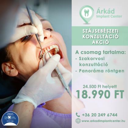 Szájsebészeti Konzultáció Akció