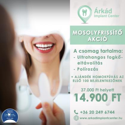 Mosolyfrissítő Akció