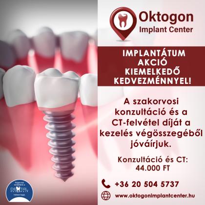 Implantátum Akció
