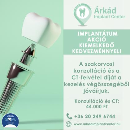 Implantátum Akció