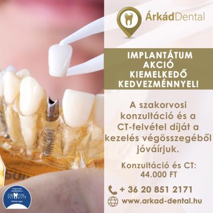 Implantátum Akció