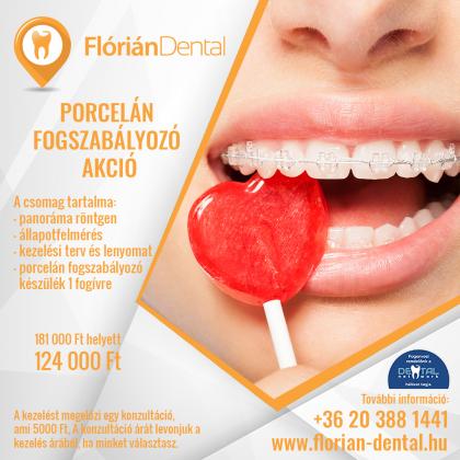 Porcelán Fogszabályozó Akció Porcelán Fogszabályozó Akció