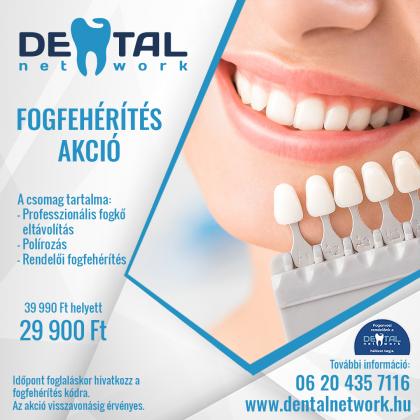 Fogfehérítés Akció Fogfehérítés Akció