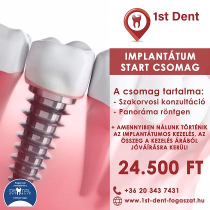 Implantátum Start Csomag