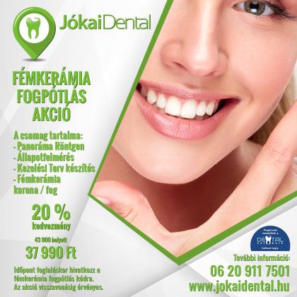 Fémkerámia Korona Akció Fémkerámia Korona Akció