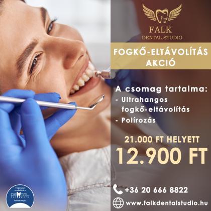 Fogkő Eltávolítás Akció