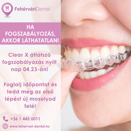 Clear X átlátszó fogszabályozó nyílt nap