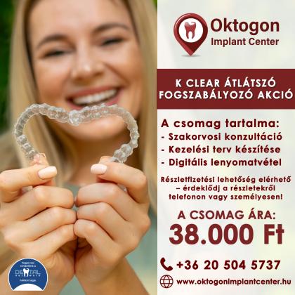 Átlátszó fogszabályozó akció