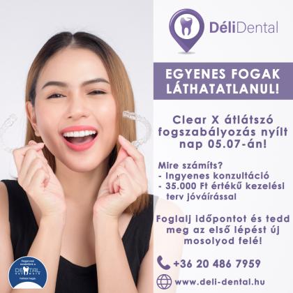 Clear X átlátszó fogszabályozó nyílt nap