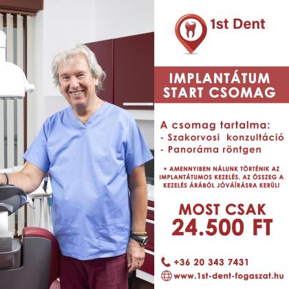 Implantátum Start Csomag Implantátum Start Csomag