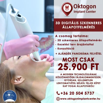 3D digitális állapotfelmérés