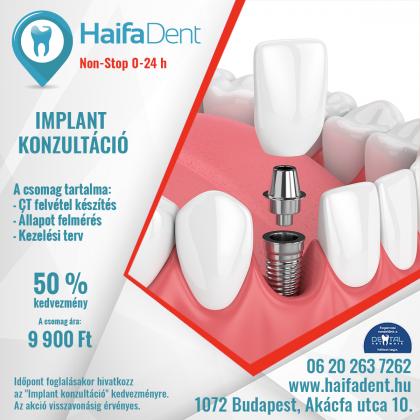 Implant Konzultáció + CT Implant Konzultáció + CT