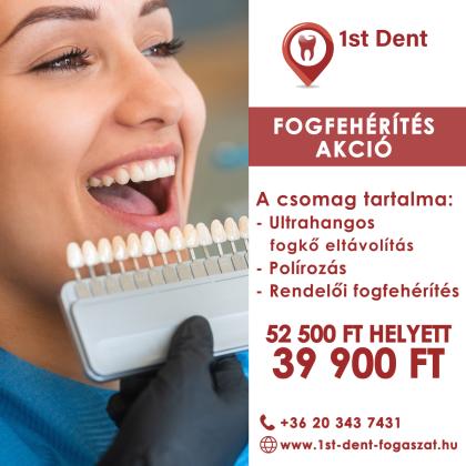 Fogfehérítés AKCIÓ