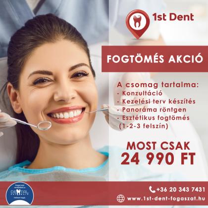 Fogtömés Akció