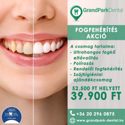 Fogfehérítés AKCIÓ Fogfehérítés AKCIÓ