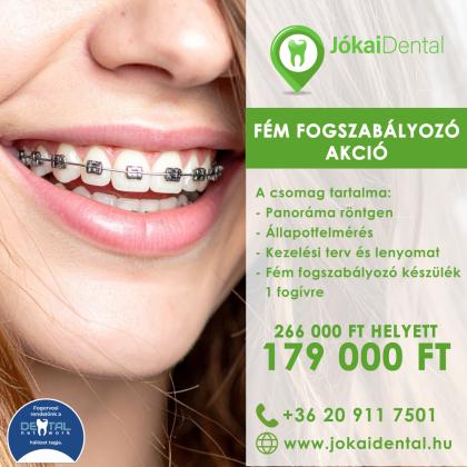 Fém Fogszabályozó Akció Fém Fogszabályozó Akció