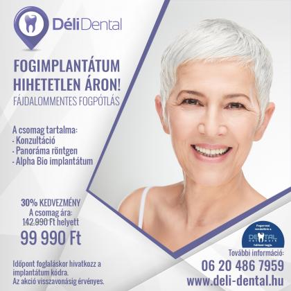 Fogimplantátum Hihetetlen áron Fogimplantátum Hihetetlen áron