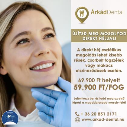 Direkt héj akció Direkt héj akció