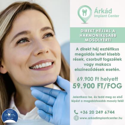 Direkt héj akció Direkt héj akció