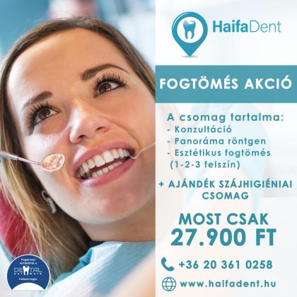 Fogtömés Akció Fogtömés Akció