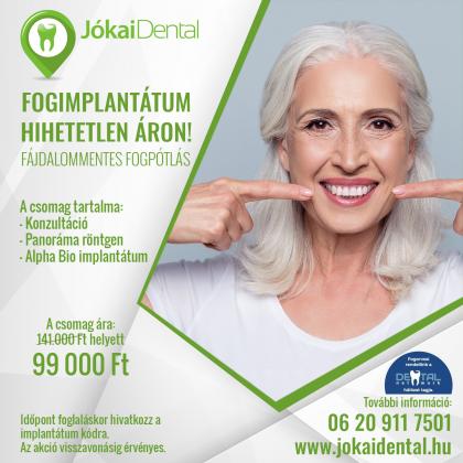 Fogimplantátum HIHETETLEN áron! Fogimplantátum HIHETETLEN áron!