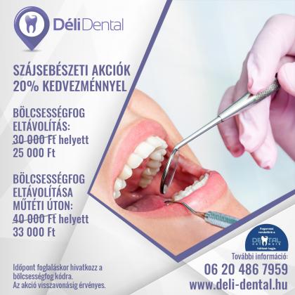 Szájsebészeti Akciók Szájsebészeti Akciók