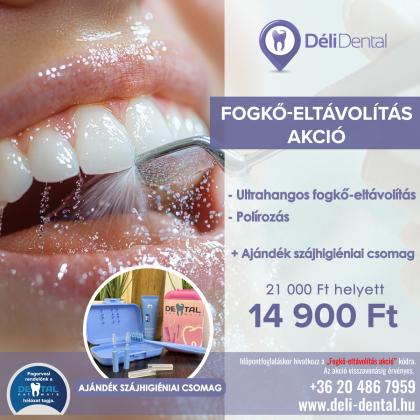Fogkő Eltávolítás AKCIÓ Fogkő Eltávolítás AKCIÓ