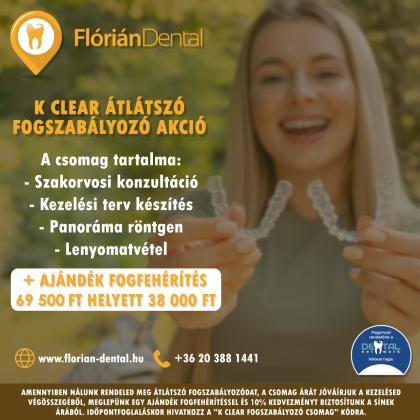 K Clear átlátszó fogszabályozó akció K Clear átlátszó fogszabályozó akció