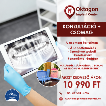 Konzultáció+ csomag Konzultáció+ csomag