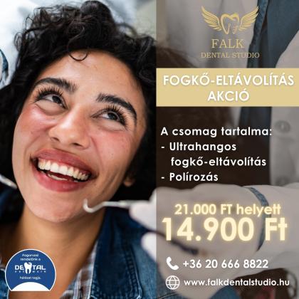 Fogkő Eltávolítás AKCIÓ Fogkő Eltávolítás AKCIÓ