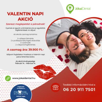 Valentin napi Akció! Valentin napi Akció!