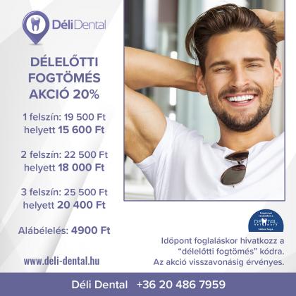 Délelőtti Fogtömés AKCIÓ Délelőtti Fogtömés AKCIÓ