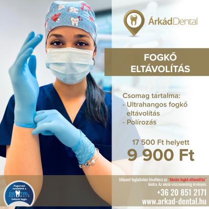 Fogkő eltávolítás AKCIÓ Fogkő eltávolítás AKCIÓ