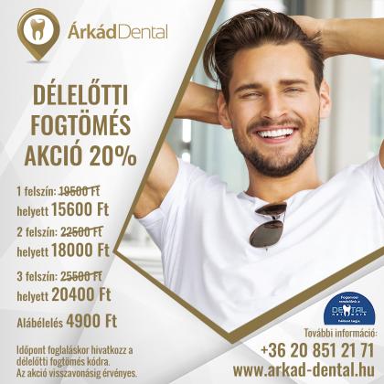 Délelőtti Fogtömés AKCIÓ Délelőtti Fogtömés AKCIÓ