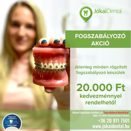 Fogszabályozás AKCIÓ