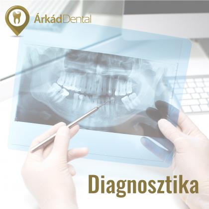 Diagnosztika - fogászati szűrés