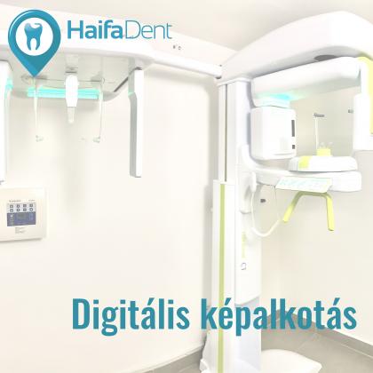 Digitális képalkotás - CT, röntgenek Digitális képalkotás - CT, röntgenek