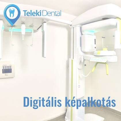 Digitális képalkotás - CT - Haifa Dent és Dentium Implant Centerben érhető el Digitális képalkotás - CT - Haifa Dent és Dentium Implant Centerben érhető el