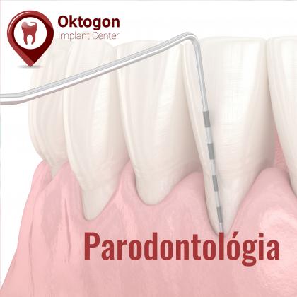 Parodontológia - az egészséges fogágyért