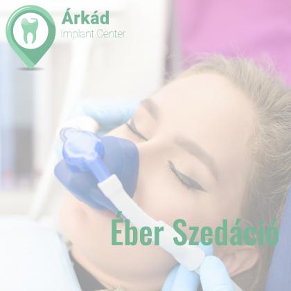 Éber Szedáció - Kizárólag az Árkád Implant Centerben