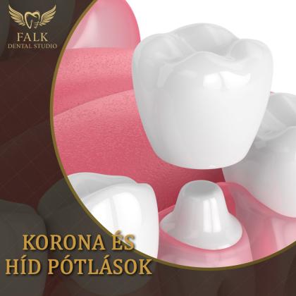 Korona és Híd pótlások