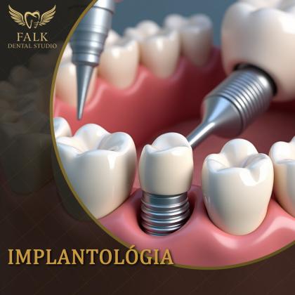 Implantológia - Éljen újra teljes életet!